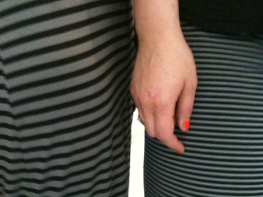 bigstripedress